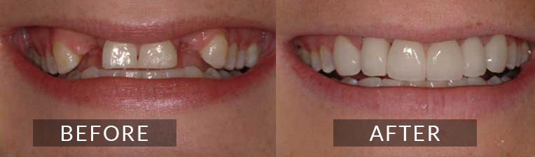 Smile Gallery - Scarborough Dentist -